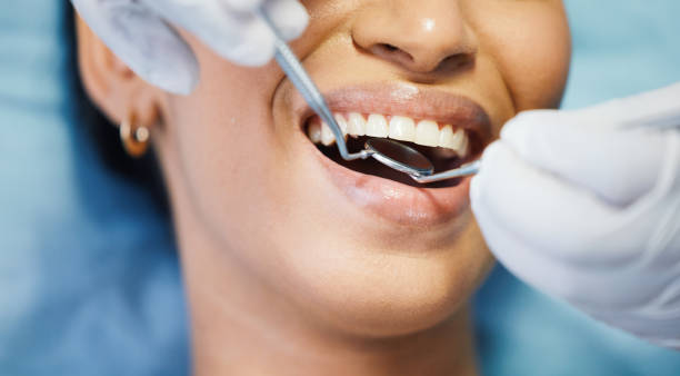 Best Broken or Cracked Tooth Emergency Dentist in Palmyra, NJ